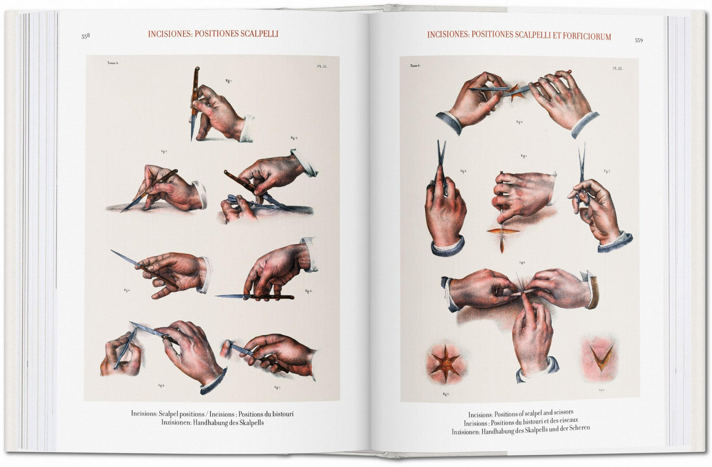 Bourgery. Atlas de anatomía humana y cirugía (Spanish, Italian, Portuguese)